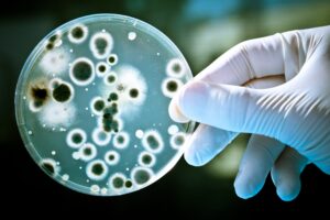 Brewery Contaminants Test